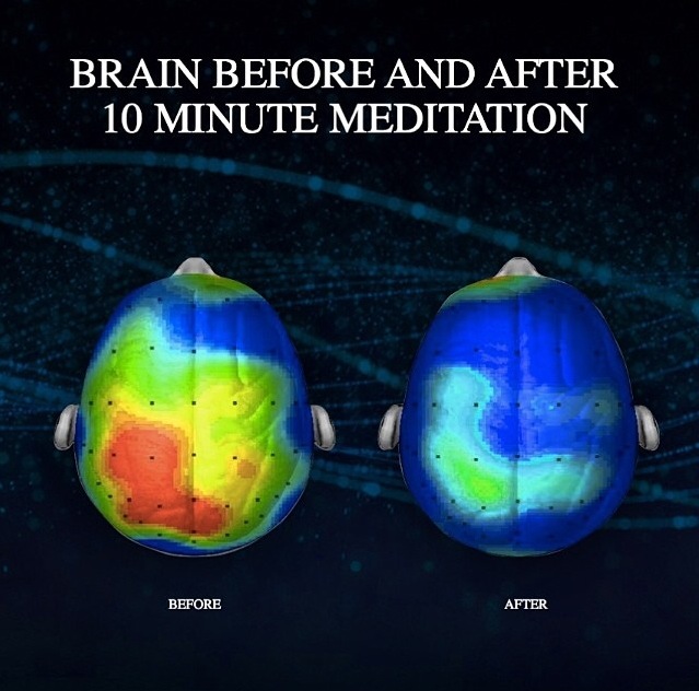 meditation-4